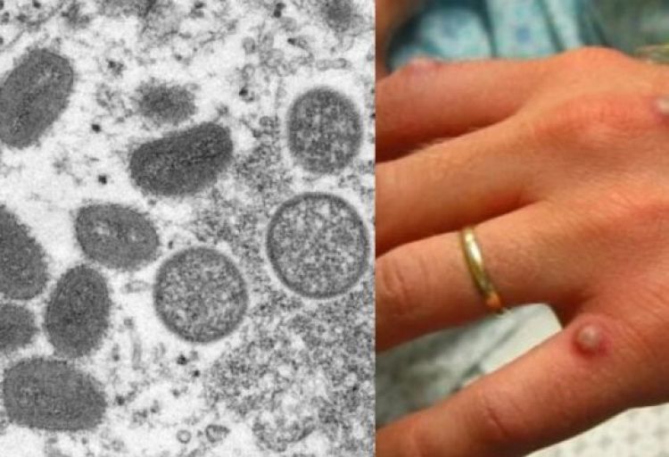 Reprodução/Montagem iG 25.5.2022