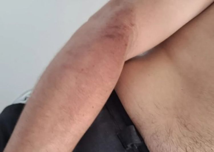 Thiago Alves mostra as agressões sofridas por apoiador do Bolsonaro em Teresina — Foto: Arquivo pessoal