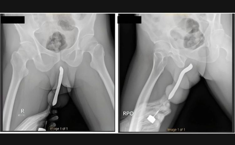 Hospital Geral Acadêmico Soetomo/ Divulgação